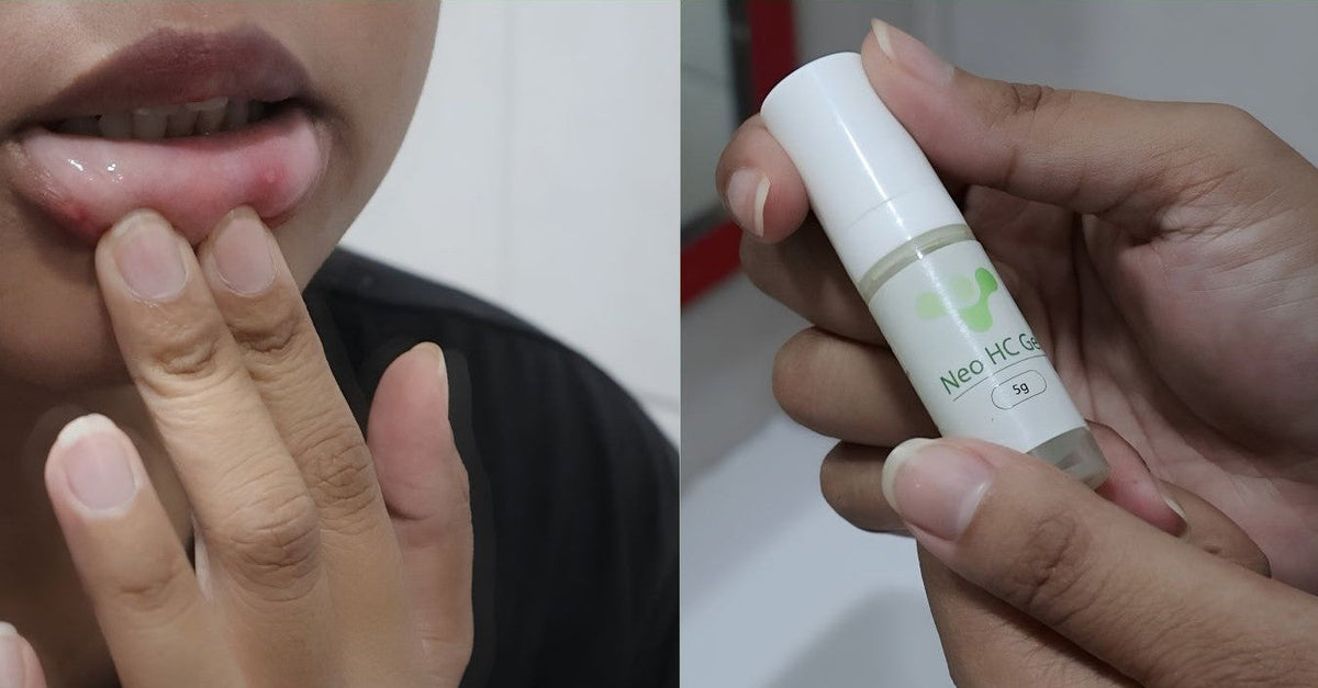 Neo HC gel: SINGaw